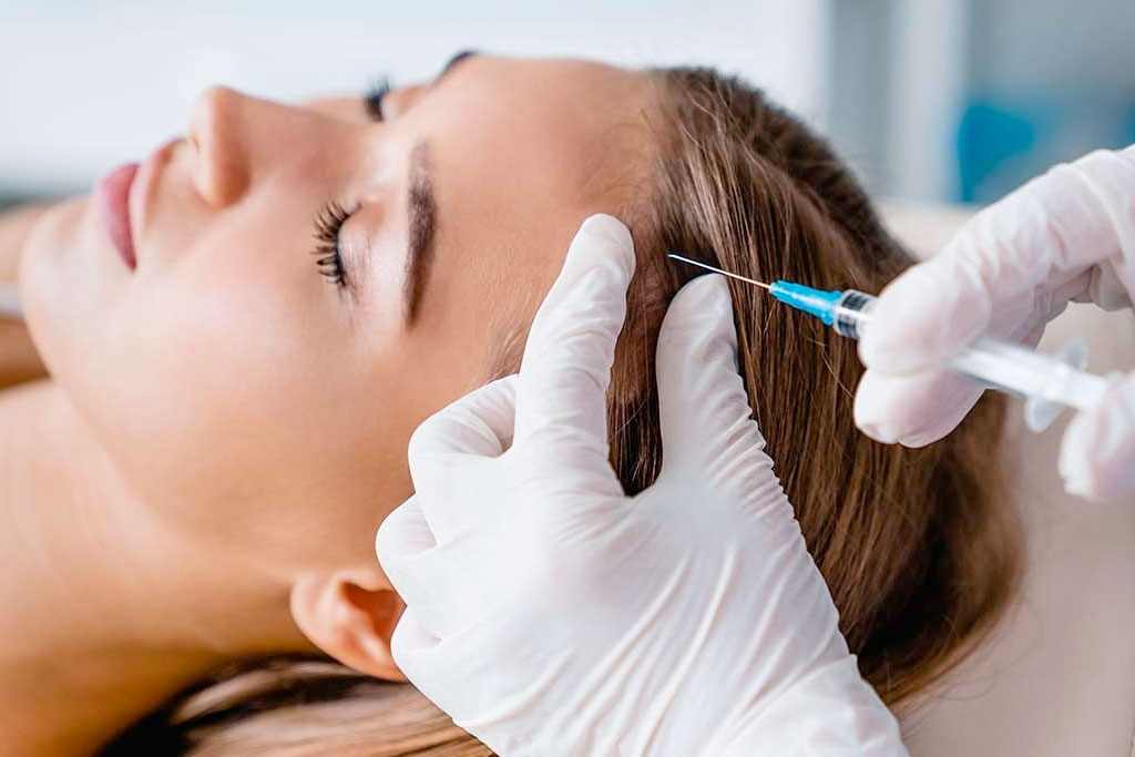 Trasplante capilar Barcelona