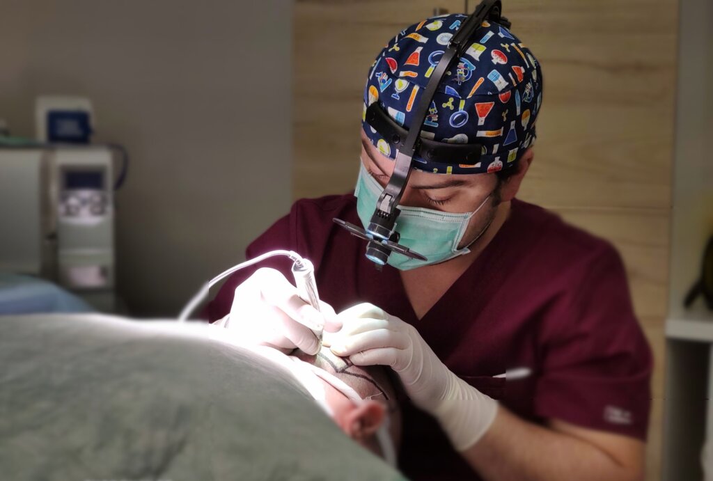 Transplantar foliculos en una cirugía